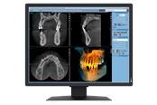 Skärm - 21" EIZO RadiForce MX217-SB - 1200x1600 - IPS - MX217-SB